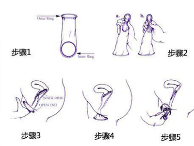 男友带避孕套只插进1厘米多一点,第二天早上少量出血
